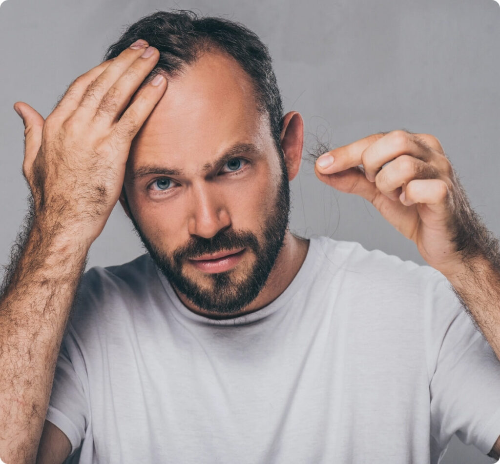 bearded-middle-aged-man-holding-fallen-hair-and-lo-2024-11-17-09-22-03-utc@2x