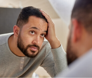 mid-adult-multiethnic-man-worried-about-hair-loss-2025-01-10-03-16-29-utc